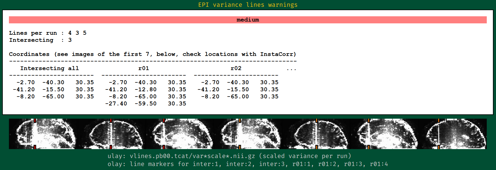 EPI_lines_concerning