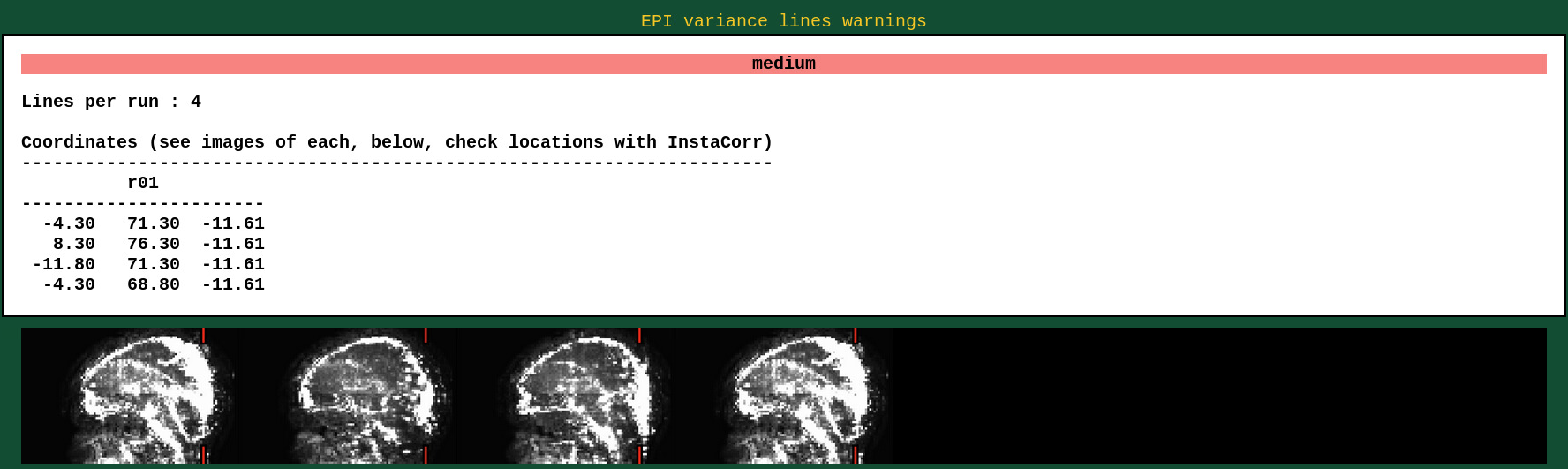 EPI_lines_non_concern3