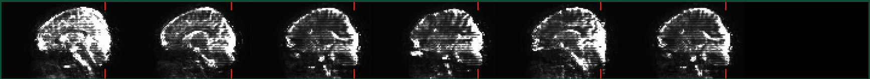 EPI_lines_non_concern1