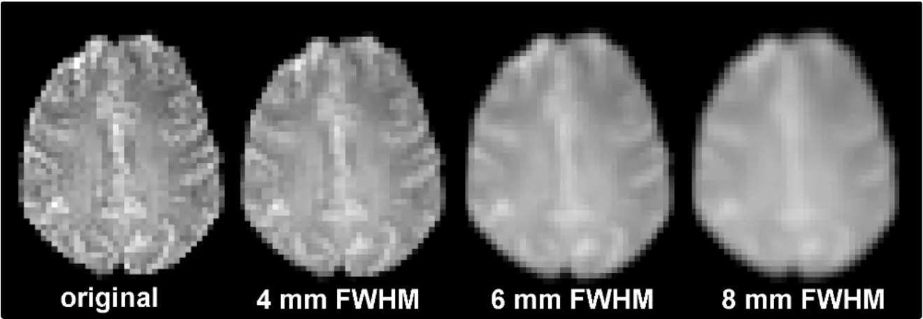 The image becomes blurry (reduced spatial resolution). The use of a Gaussian spatial filter efficiently distributes the intensity of each voxel across adjacent voxels.