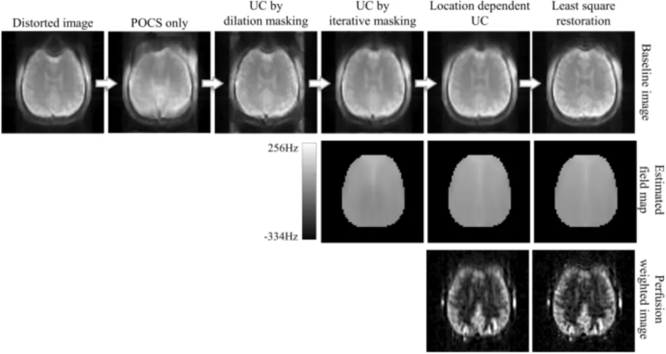 Figure: Hutton C, Bork A, Josephs O, Deichmann R, Ashburner J, Turner R. Image distortion correction in fMRI: A quantitative evaluation. Neuroimage. 2002 May;16(1):217-40. doi: 10.1006/nimg.2001.1054. PMID: 11969330.